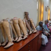Steps Toward Hope: A Gift of Limbs and Love